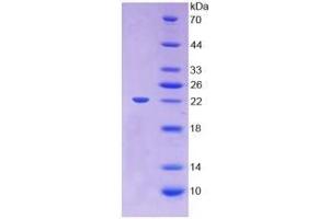 Figure. (LCAT Protein (AA 41-210) (His tag))