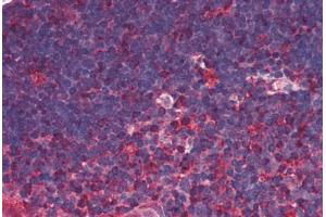 Human Thymus (formalin-fixed, paraffin-embedded) stained with TRDMT1 antibody ABIN290198 at 5 ug/ml followed by biotinylated anti-mouse IgG secondary antibody ABIN481714, alkaline phosphatase-streptavidin and chromogen. (Dnmt2 anticorps)