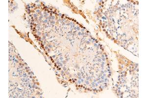 ABIN6267251 at 1/100 staining mouse testicular tissue sections by IHC-P.