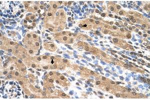 Human kidney (Eukaryotic Translation Initiation Factor 3, Subunit M (EIF3M) (N-Term) anticorps)