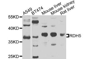 Western blot analysis of extracts of various cells, using RDH5 antibody. (RDH5 anticorps)