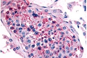 Human Testis (formalin-fixed, paraffin-embedded) stained with HTR1E antibody ABIN213509 at 16-24 ug/ml followed by biotinylated goat anti-rabbit IgG secondary antibody ABIN481713, alkaline phosphatase-streptavidin and chromogen.