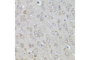 Immunohistochemistry of paraffin-embedded mouse brain using IL13 antibody (ABIN5971115) (40x lens). (IL-13 anticorps)