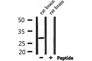 Western blot analysis of extracts from rat brain, using ATF1 Antibody. (AFT1 anticorps  (Internal Region))