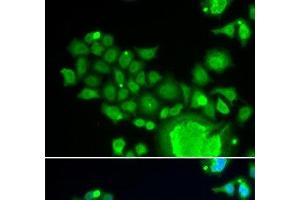 Immunofluorescence analysis of HeLa cells using FZR1 Polyclonal Antibody (FZR1 anticorps)