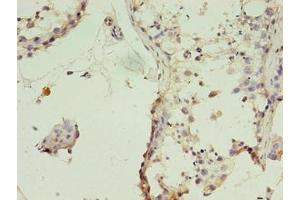 Immunohistochemistry of paraffin-embedded human testis tissue using ABIN7159886 at dilution of 1:100 (TIMM10B anticorps  (AA 1-103))