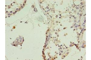 Immunohistochemistry of paraffin-embedded human testis tissue using ABIN7159886 at dilution of 1:100 (TIMM1B (AA 1-103) anticorps)