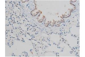 ABIN6267398 at 1/200 staining Rat lung tissue sections by IHC-P. (H2AFX anticorps  (pSer139))