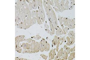 Immunohistochemistry of paraffin-embedded mouse heart using FGF2 antibody (ABIN1872685) at dilution of 1:100 (40x lens). (FGF2 anticorps)