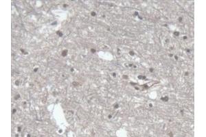 Detection of LRP1B in Human Cerebrum Tissue using Polyclonal Antibody to Low Density Lipoprotein Receptor Related Protein 1B (LRP1B) (LRP1B anticorps  (AA 31-194))