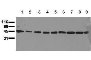Western Blotting (WB) image for anti-Mitogen-Activated Protein Kinase Kinase 1 (MAP2K1) antibody (ABIN126837) (MEK1 anticorps)
