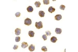 Immunohistochemistry (IHC) image for anti-B-Cell CLL/lymphoma 2 (BCL2) (Middle Region) antibody (ABIN1030884) (Bcl-2 anticorps  (Middle Region))