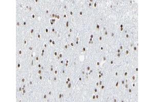 ABIN6266532 at 1/100 staining human brain tissue sections by IHC-P.