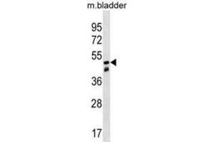 Western Blotting (WB) image for anti-Sorting Nexin 8 (SNX8) antibody (ABIN3000289) (SNX8 anticorps)
