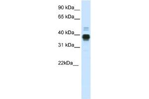 WB Suggested Anti-HOXA11 Antibody Titration:  0. (Homeobox A11 anticorps  (C-Term))