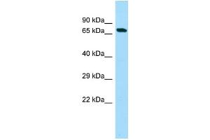 WB Suggested Anti-C20orf112 Antibody Titration: 1. (C20orf112 anticorps  (N-Term))