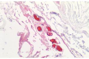 Detection of LIPB in Human Breast Tissue using Polyclonal Antibody to Lipophilin B, Prostatein Like (LIPB)