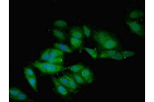 Immunofluorescent analysis of Hela cells using ABIN7145684 at dilution of 1:100 and Alexa Fluor 488-congugated AffiniPure Goat Anti-Rabbit IgG(H+L)
