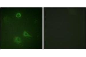 Immunofluorescence analysis of A549 cells, using NMDAR1 (Phospho-Ser890) Antibody. (GRIN1/NMDAR1 anticorps  (pSer890))