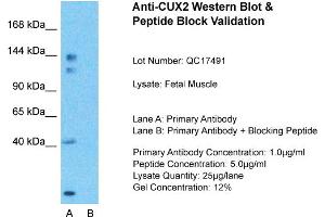 Host:  Rabbit  Target Name:  CUX2  Sample Type:  Fetal Muscle  Lane A:  Primary Antibody  Lane B:  Primary Antibody + Blocking Peptide  Primary Antibody Concentration:  1ug/ml  Peptide Concentration:  5ug/ml  Lysate Quantity:  25ug/lane/Lane  Gel Concentration:  0. (CUX2 anticorps  (N-Term))