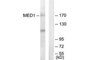 Western blot analysis of extracts from Jurkat cells, using MED1 Antibody. (MED1 anticorps  (AA 641-690))