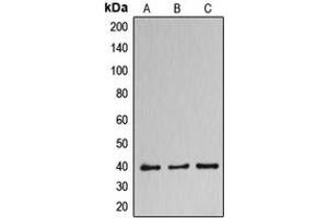 Western blot analysis of DNAJB11 expression in HuvEc (A), NCIH460 (B), MCF7 (C) whole cell lysates. (DNAJB11 anticorps  (Center))