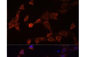 Immunofluorescence analysis of NIH-3T3 cells using PSMD14 Polyclonal Antibody at dilution of 1:100 (40x lens). (PSMD14 anticorps)