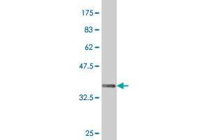 Western Blot detection against Immunogen (37. (HHEX anticorps  (AA 133-237))