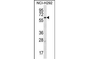 Western blot analysis in NCI-H292 cell line lysates (35ug/lane). (MBTPS2 anticorps  (N-Term))