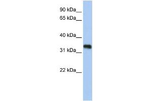 WB Suggested Anti-C6orf140 Antibody Titration:  0. (GLYATL3 anticorps  (N-Term))