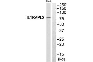 Western Blotting (WB) image for anti-Interleukin 1 Receptor Accessory Protein-Like 2 (IL1RAPL2) (Internal Region) antibody (ABIN1852772)