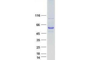 Validation with Western Blot