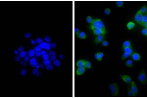 Human pancreatic carcinoma cell line MIA PaCa-2 was stained with Mouse Anti-Cytokeratin 18-UNLB, and DAPI. (Chèvre anti-Souris IgG (Heavy & Light Chain) Anticorps (Biotin) - Preadsorbed)