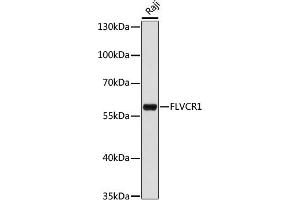 Western blot analysis of extracts of Raji cells, using FLVCR1 antibody (ABIN7267164) at 1:1000 dilution. (FLVCR anticorps  (AA 250-350))