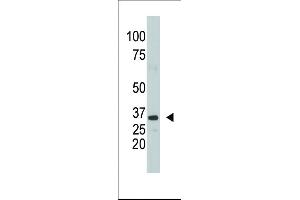 The anti-SULT1A1 Pab (ABIN389136 and ABIN2839312) is used in Western blot to detect SULT1A1 in mouse kidney tissue lysate.
