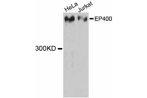Western blot analysis of extracts of various cell lines, using EP400 antibody (ABIN5997682) at 1:3000 dilution. (EP400 anticorps)