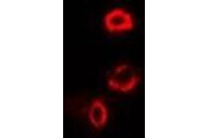 Immunofluorescent analysis of OGDH staining in U2OS cells. (alpha KGDHC anticorps)