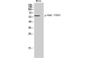 Western Blotting (WB) image for anti-Checkpoint Kinase 2 (CHEK2) (pThr383) antibody (ABIN3182426) (CHEK2 anticorps  (pThr383))