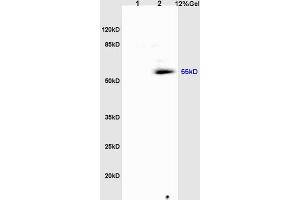 L1 rat heart lysates, L2 rat brain lysates probed: Anti-Tubulin-alpha (ABIN725630) at 1:200 in 4 °C.