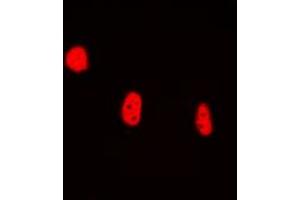 Immunofluorescent analysis of BRAF35 staining in HEK293T cells. (HMG20B anticorps  (N-Term))
