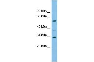WB Suggested Anti-DUS1L Antibody Titration: 0. (DUS1L anticorps  (Middle Region))