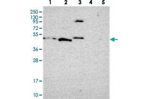 Western blot analysis of Lane 1: RT-4, Lane 2: U-251 MG, Lane 3: Human Plasma, Lane 4: Liver, Lane 5: Tonsil with FBRS polyclonal antibody  at 1:250-1:500 dilution. (Fibrosin anticorps)