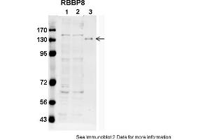 Sample type: 1. (Retinoblastoma Binding Protein 8 anticorps  (C-Term))