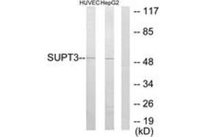 Western Blotting (WB) image for anti-Suppressor of Ty 3 Homolog (SUPT3H) (AA 171-220) antibody (ABIN2889347) (SUPT3H/SPT3 anticorps  (AA 171-220))