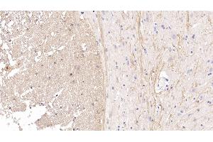 Detection of CDNF in Rat Spinal cord Tissue using Monoclonal Antibody to Cerebral Dopamine Neurotrophic Factor (CDNF) (CDNF anticorps  (AA 20-183))