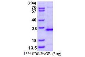 Image no. 1 for Ras Homolog Family Member G (RHOG) (AA 1-188) protein (His tag) (ABIN1098313)