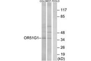 Western blot analysis of extracts from COLO/MCF-7 cells, using OR51G1 Antibody. (OR51G1 anticorps  (AA 199-248))