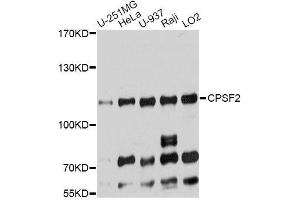 Western blot analysis of extracts of various cell lines, using CPSF2 antibody (ABIN5996261) at 1:7000 dilution. (CPSF2 anticorps)