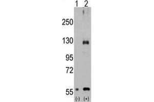 Western blot analysis of TRPM8 antibody and 293 cell lysate either nontransfected (Lane 1) or transiently transfected with the TRPM8 gene (2). (TRPM8 anticorps  (AA 521-552))