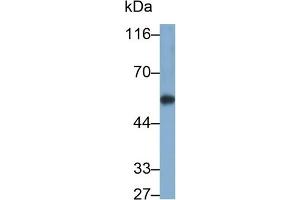 Detection of CYP1A1 in Rat Liver lysate using Polyclonal Antibody to Cytochrome P450 1A1 (CYP1A1) (CYP1A1 anticorps  (AA 251-521))